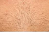 human skin hairy 0001